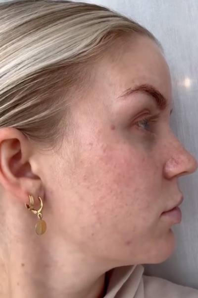 Before - Amanda L.