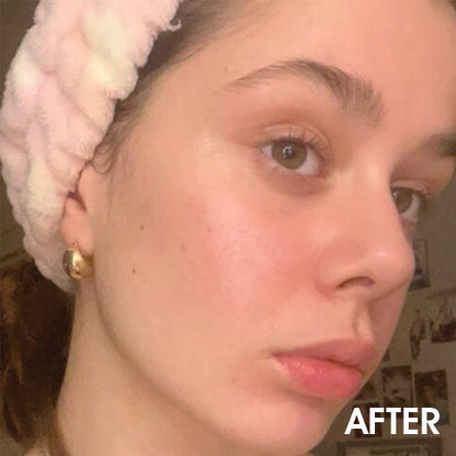 Renewal & Rejuvenation Toner Pads