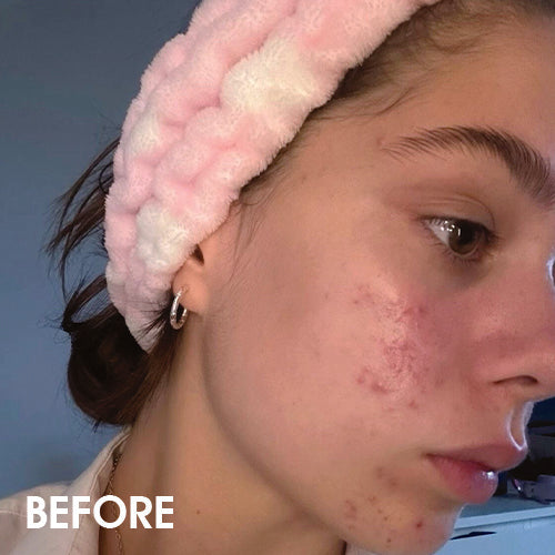 Renewal & Rejuvenation Toner Pads