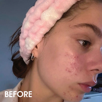 Renewal & Rejuvenation Toner Pads