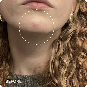 JiYu Anti-Aging Glow-Up Bundle