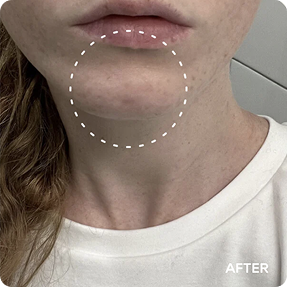 Renewal & Rejuvenation Toner Pads