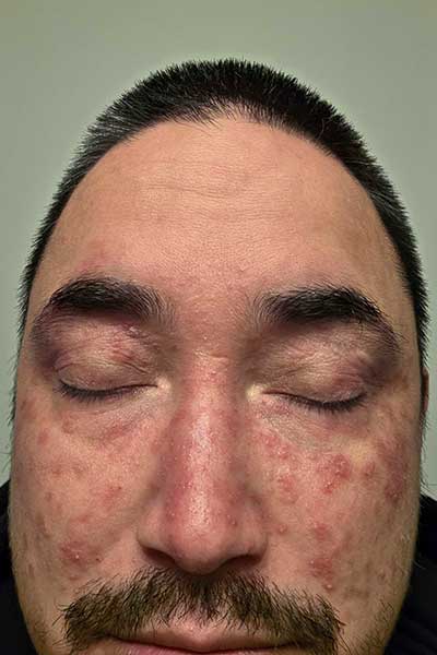 Before - Nate S.