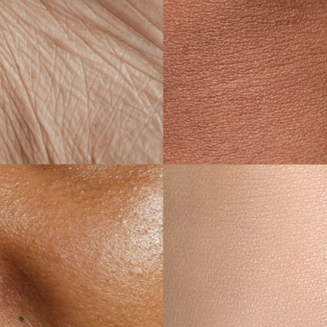 Four close-ups of skin in different tones and textures arranged in a grid